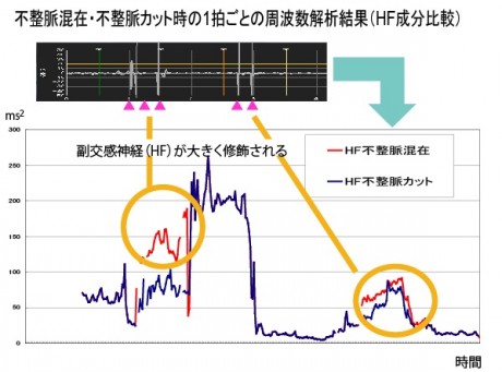 不整脈混在にすると